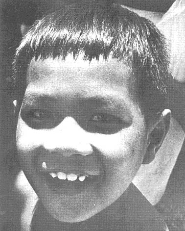 Vietnamese child